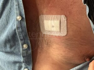 MÜNCHEN - 💬 "Sie stürmte auf mich zu!" Messer-Opfer aus München schildert Horror-Attacke seiner Nachbarin (30) am Samstagabend (07.06.2025)! 🔪