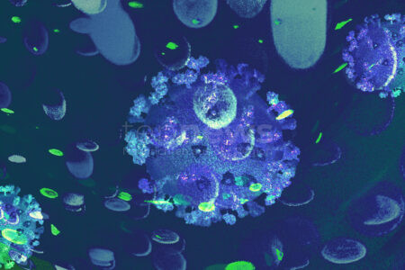 PFAFFENHOFEN AN DER ILM - 🦠 Borna-Virus fordert zweites Todesopfer! Patient starb in der Nacht auf Montag (30.06.2025) - Infektionsweg weiterhin ungeklärt! 🕊️