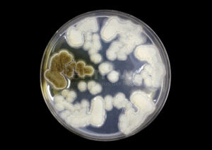 BERLIN / GENF - 🦠 Gefährlicher Pilz Candida auris breitet sich aus! Sterblichkeitsrate 53 Prozent - auch Deutschland steigende Vorfälle! ⚠️