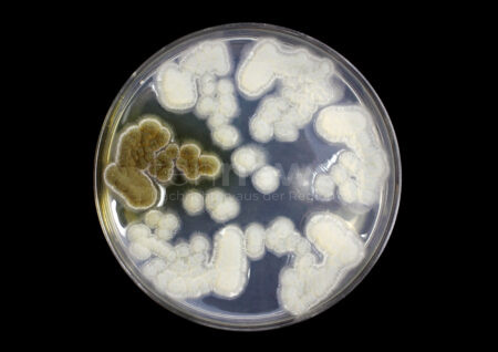 BERLIN / GENF - 🦠 Gefährlicher Pilz Candida auris breitet sich aus! Sterblichkeitsrate 53 Prozent - auch Deutschland steigende Vorfälle! ⚠️